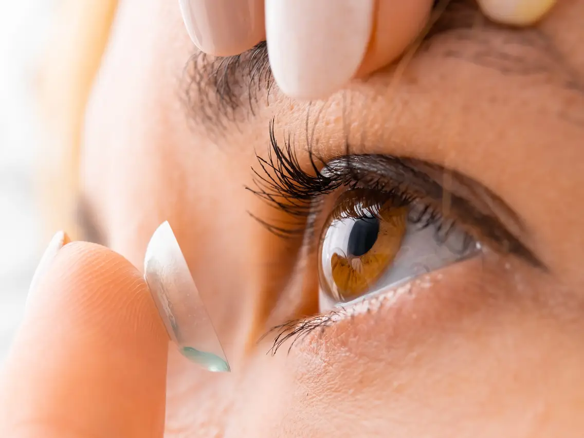 Contact Lens Fitting